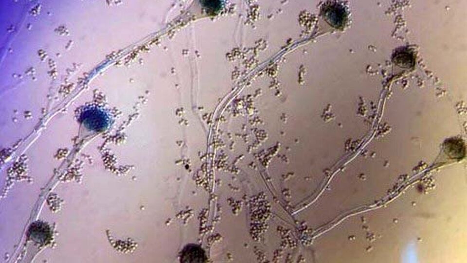 hongo infección coronavirus