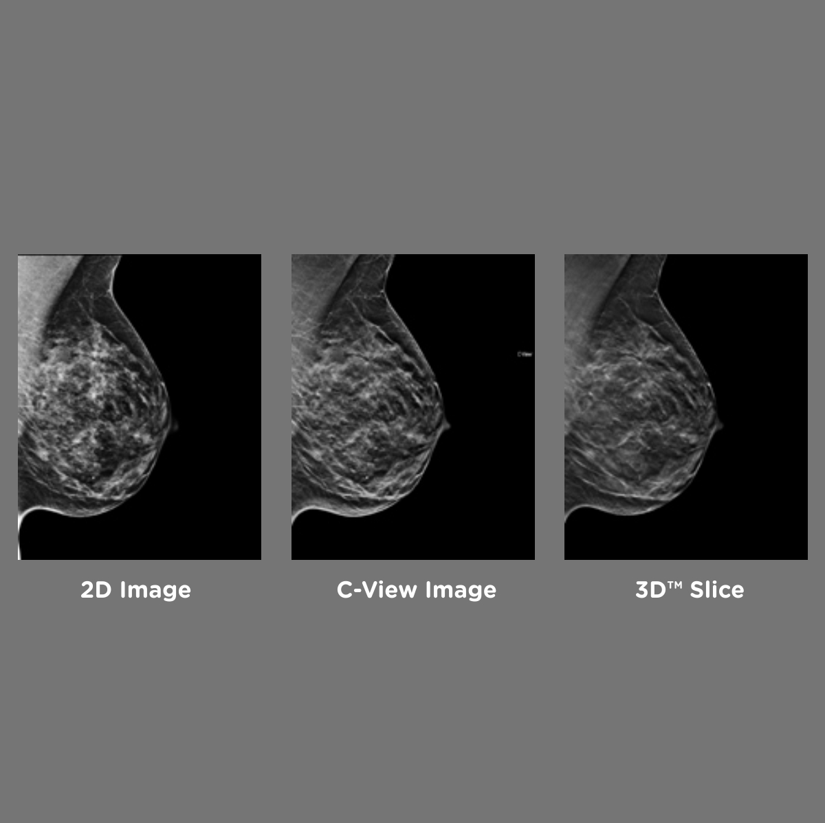 mamografías 3D en Mar del Plata