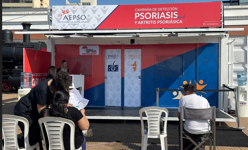Detección y controles gratuitos de enfermedad psoriásica